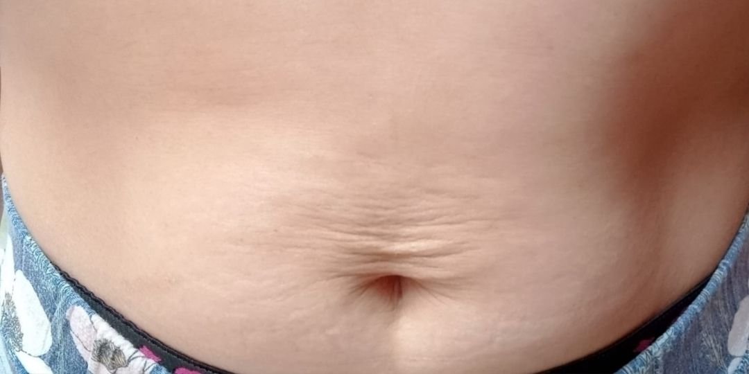 Antes