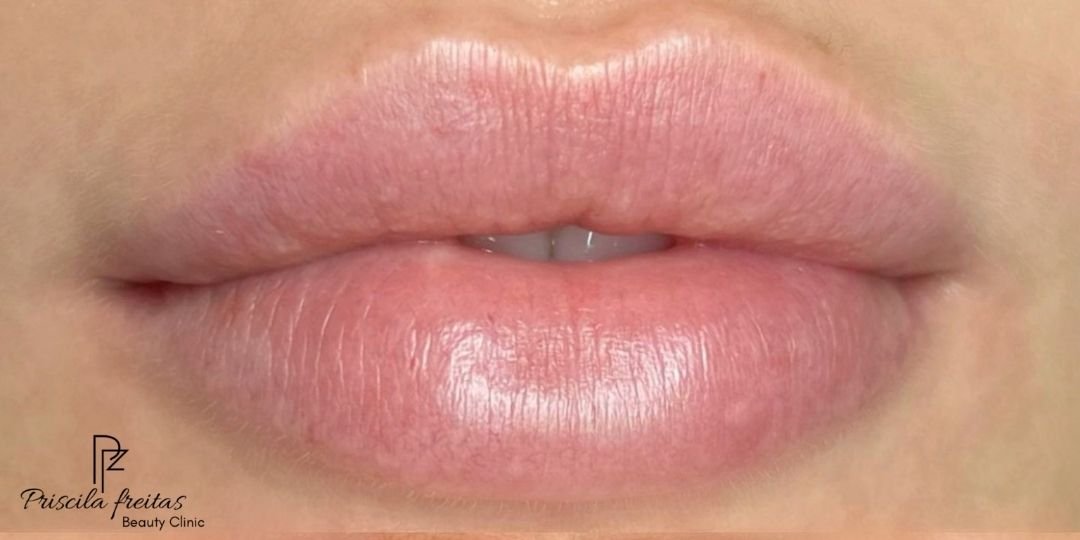 Antes